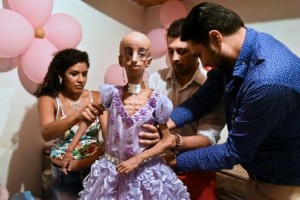 Magali, una niña con progeria, cumple 15 años con aspecto de 90