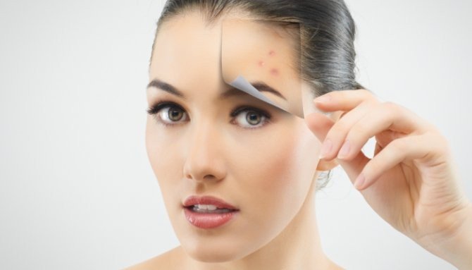 ¿Tienes la piel grasa y acné? aprende como maquillarte con estos tips