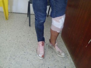 Jarabacoa: Policía hiere de bala menor tras asaltar motoconchista