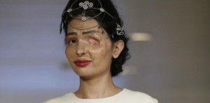 Víctima de ataque con ácido se impone en la Semana de la Moda de Nueva York