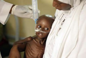 ONU: 75.000 niños podrían morir de hambre en Nigeria