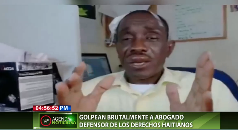 Golpean brutalmente a abogado defensor de los derechos haitianos