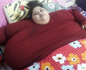 Cirugía bariátrica, la última esperanza para la mujer más obesa del mundo que pesa casi 500 kilos