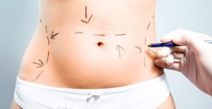 Lo que usted debe saber si se va a realizar una cirugía del abdomen