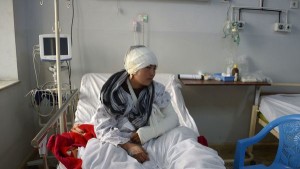 Zarina, una afgana mutilada por su marido suplica ayuda al mundo