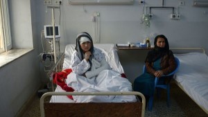 Zarina, una afgana mutilada por su marido suplica ayuda al mundo