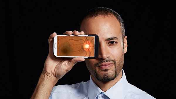 La app revolucionaria que diagnostica problemas oculares