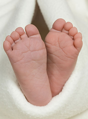 Operan con éxito a un niño indio nacido con cuatro piernas y dos penes