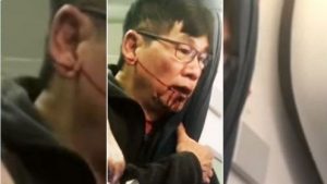  Pasajero que fue expulsado violentamente del avión de United necesita cirugía plástica