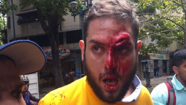 Colectivos chavistas agreden brutalmente al diputado opositor durante una protesta en Caracas