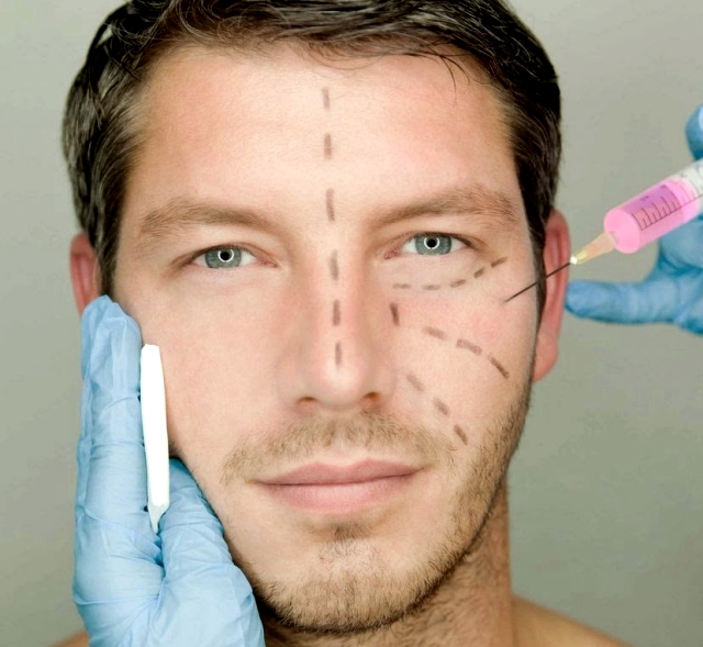 Conoce cuáles son las cirugías estéticas más comunes ente los hombres
