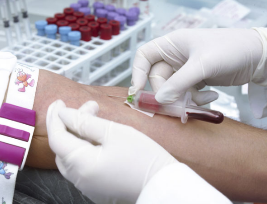 ¿Por qué se deben hacer los análisis de sangre en ayunas?