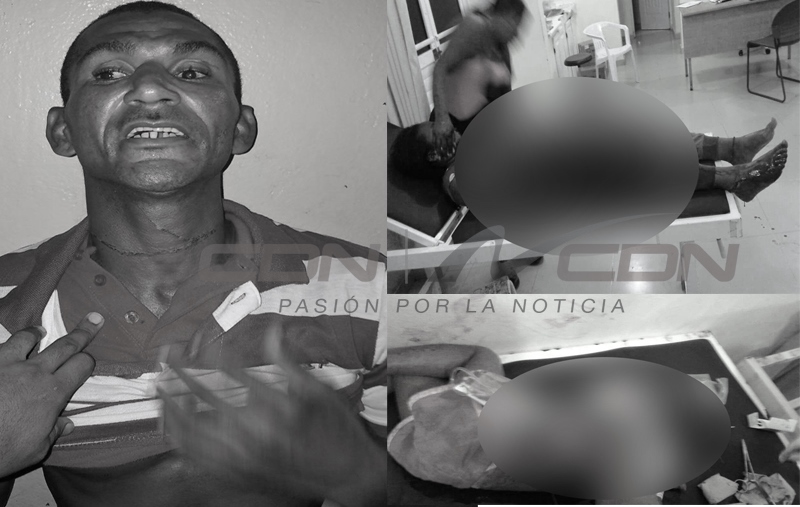 Apresan acusado de herir con machete mujer y niña de cuatro años en La Bija de Cotuí