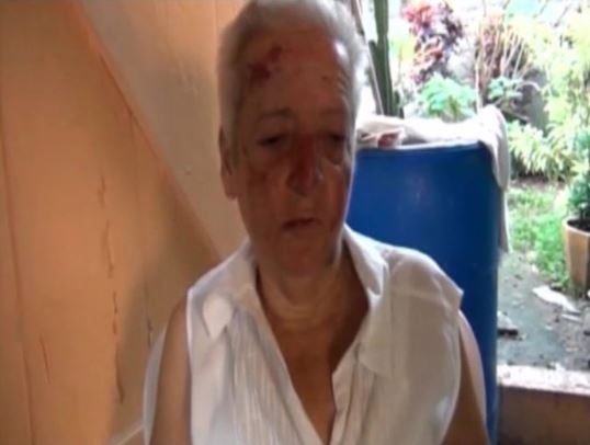 Ladrón golpea y amordaza anciana dentro de vivienda en Dajabón