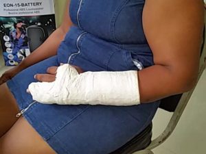 Denuncian joven fue “brutalmente” golpeada por su expareja en Sánchez de Samaná