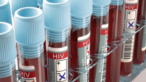 ¿Conoces las causas del VIH en América Latina?