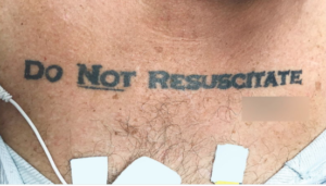 Hombre llega inconsciente al hospital con un tatuaje 'No resucitar' y deja perplejos a los médicos