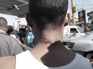 Al menos ocho heridos por enfrentamientos durante protestas de transportistas en Santiago