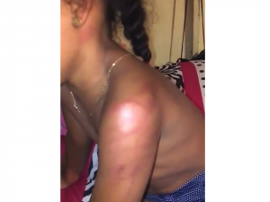 Mujer agrede brutalmente a sobrina de 7 años en Bayaguana 