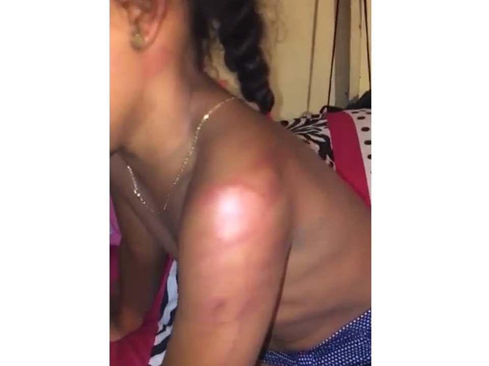 Mujer agrede brutalmente a sobrina de 7 años en Bayaguana