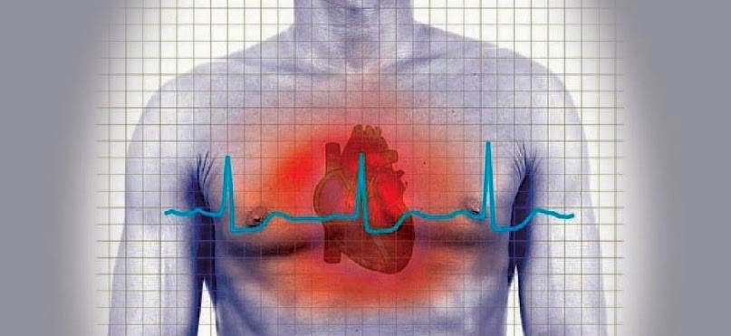 Salud Pública y Yunén capacitan a colaboradores en cardio protección