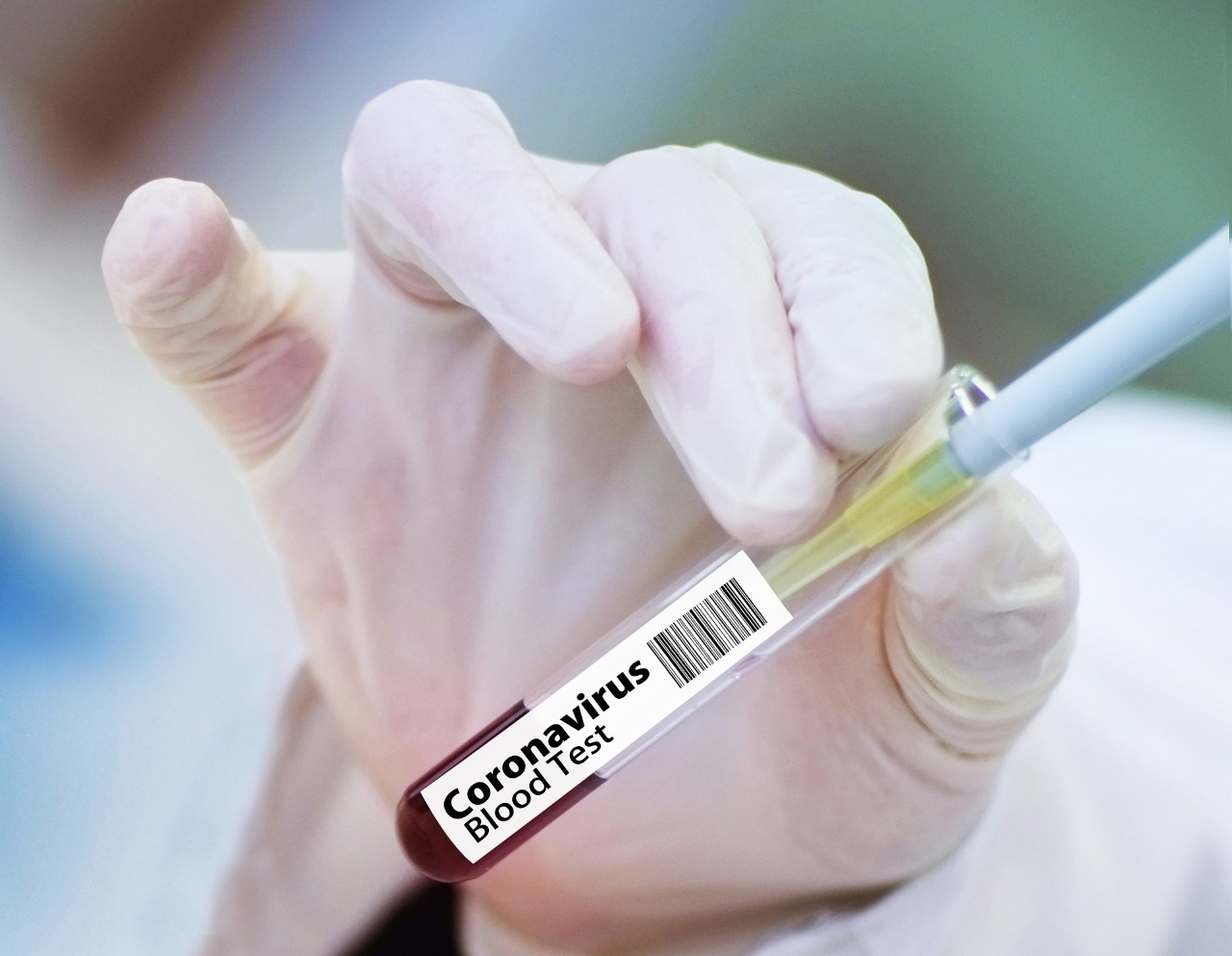 Por quinto día no se registran muertes por coronavirus