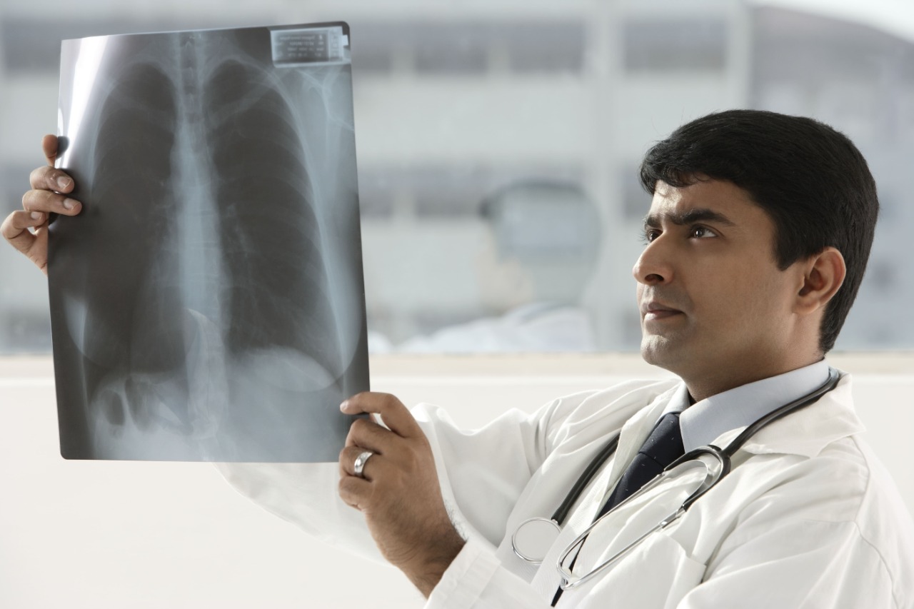 Pacientes EPOC con más riesgo de desarrollar cáncer de pulmón