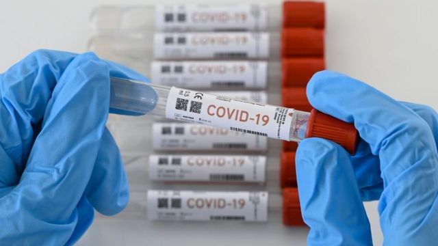 Coronavirus: Salud Pública reporta 5,953 nuevos casos