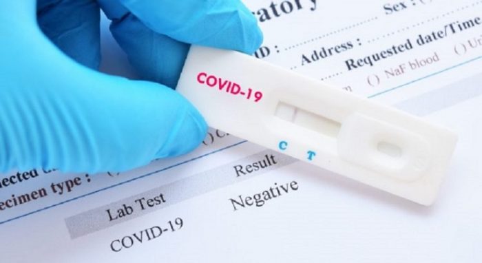 Coronavirus: Salud Pública reporta 1,017 nuevos casos y dos decesos