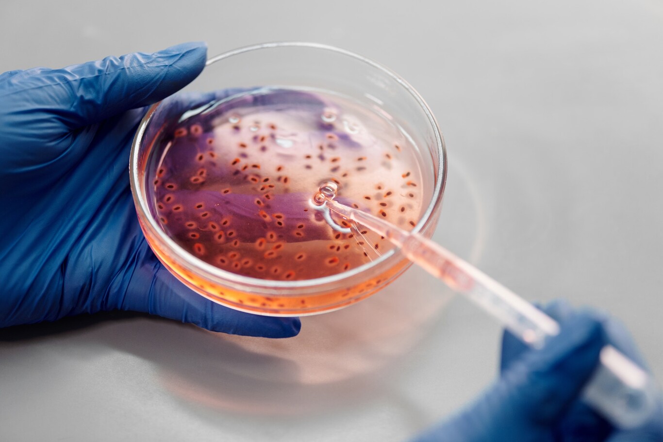Biotecnólogos editarán genoma del cólera para disminuir proliferación