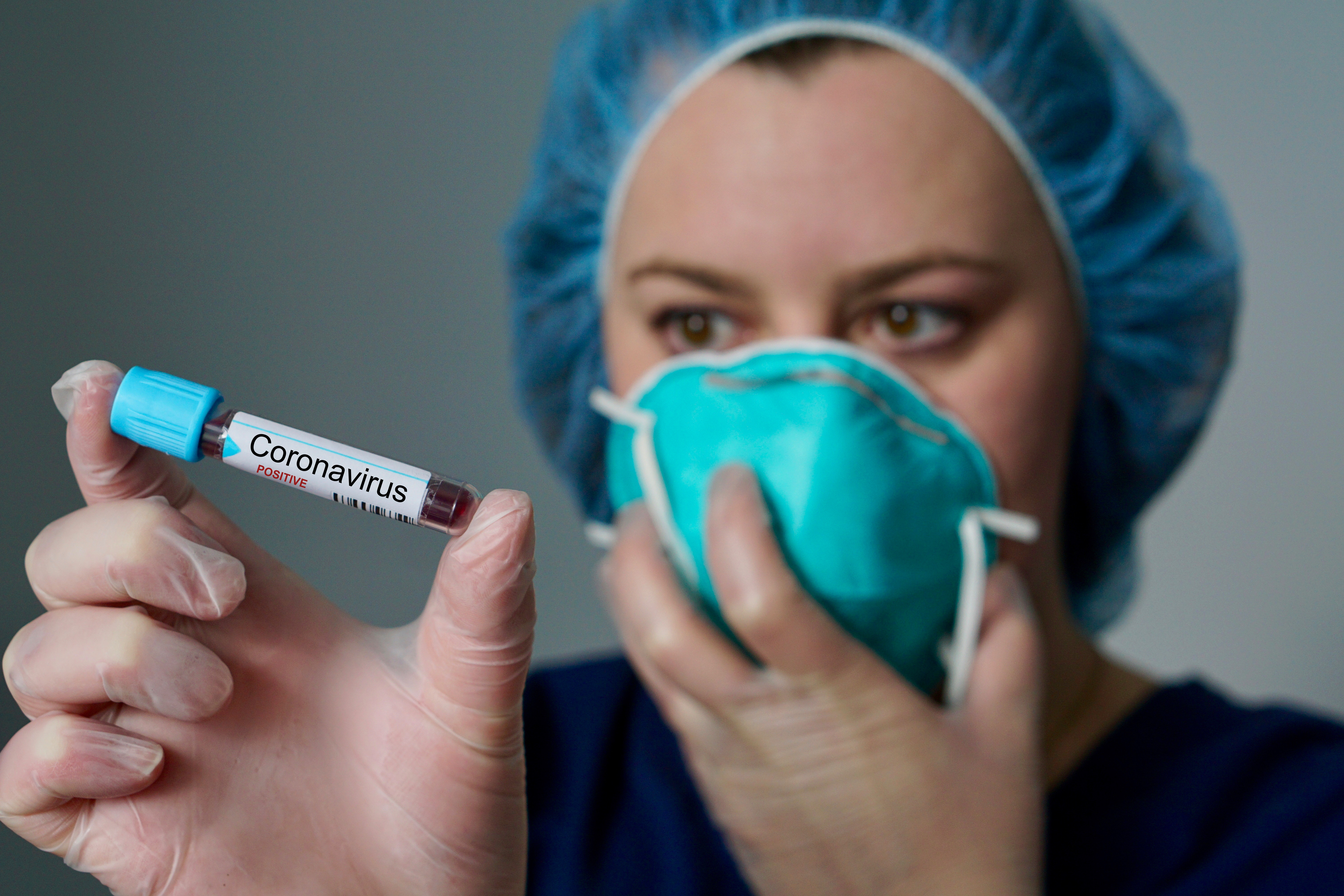Coronavirus: Salud Pública reporta 171 nuevos casos sin defunciones