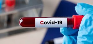 Casos globales COVID bajan un 14 %; OMS pide no reducir los tests