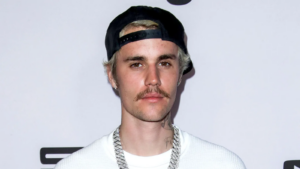 Justin Bieber sufre de un grave virus que le paralizó medio rostro